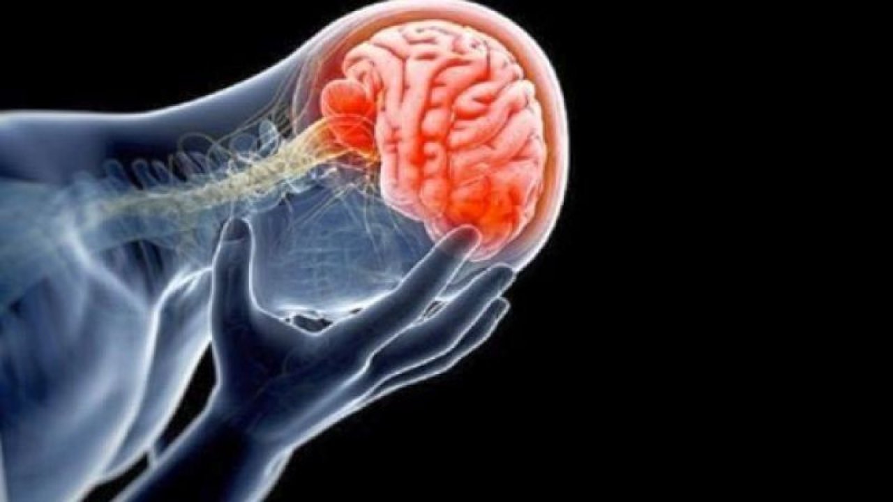 Baş Ağrısına Dikkat! Beyin Damarlarınızda Gizli Tehlike! Baş Ağrısının Altında Yatan Asıl Sorun Nedir?