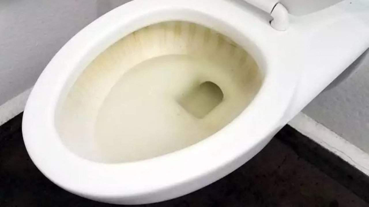 Sararmış Ya Da Kireçlenmiş Tuvalet Taşları İçin Çözüm Yolları Açıklandı! İşte O Yollar!