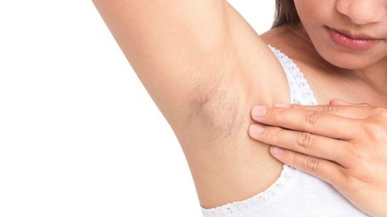 Her adımı dikkatlice not alın: İlkbaharda koltuk altı terlemelerine son verecek rutin belli oldu! İşte ilkbaharda koltuk altı bakımı yapmanın adımları