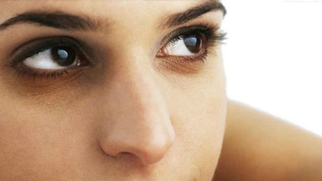 Göz Altı Morlukları ve Şişkinlikleri İçin Doğal Maske! Kimyasal Ürün Kullanmaya Gerek Kalmayacak!