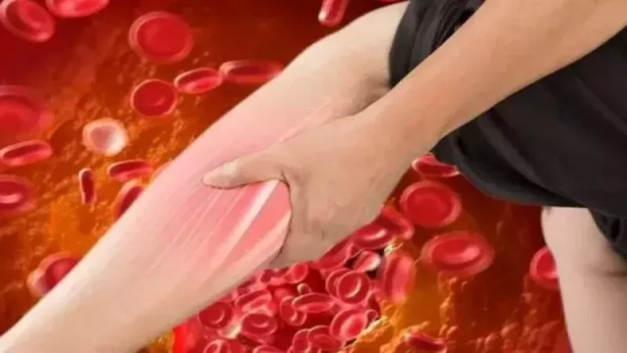 Ayaklarınız Kolesterol İçin İşaret Veriyor Olabilir! Kırılgan Tırnakları Ciddiye Alın!