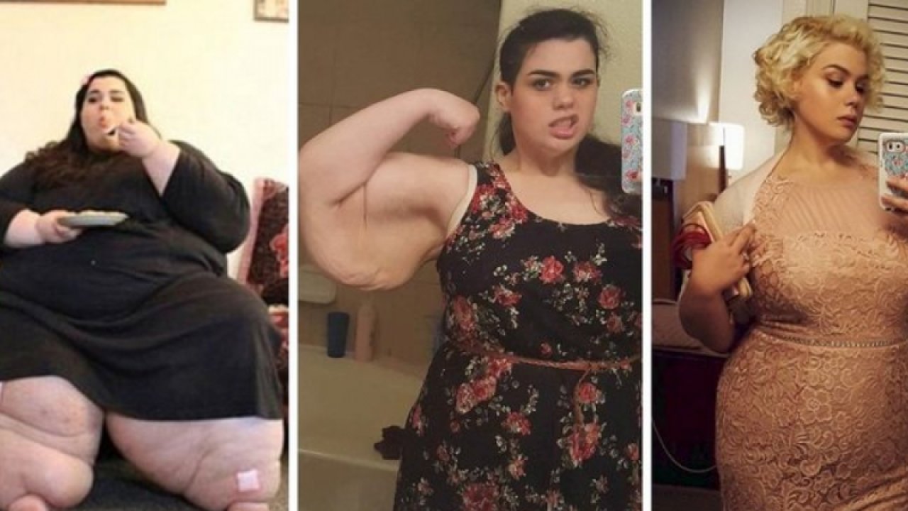 Kiloları yüzünden genç yaşta öleceği söylendi! Hırsıyla tam 200 kilo verdi: Şimdiki halini görenler inanamıyor...
