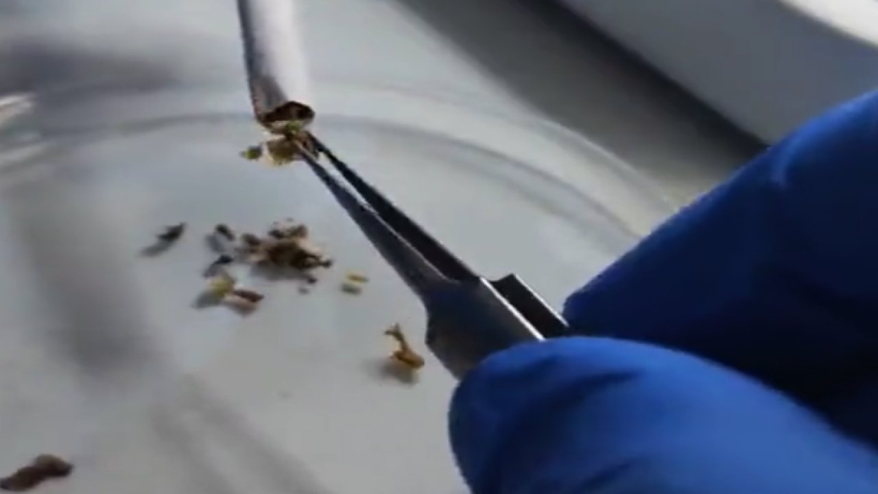 Sigaranın içindekilerin videosu gösterildi! Bakın Sigaranın İçerisinde neler varmış? Mide Bulandırıyor!.. VİDEO HABER