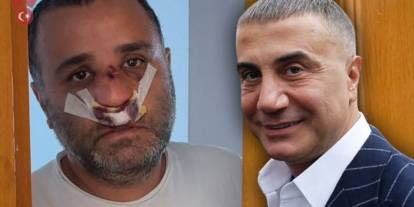 Sedat Peker’den Marmaray’daki Saldırı Mağduruna 2,5 Milyon TL’lik Destek: "İlahi Adalet Yerini Bulur"