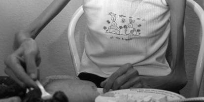 Anoreksiya Nervoza Nedir? Belirtileri, Nedenleri ve Tedavi Süreci