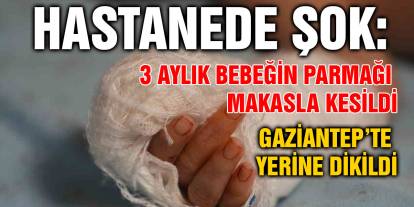 Hastanede Şok: 3 Aylık Bebeğin Parmağı Makasla Kesildi
