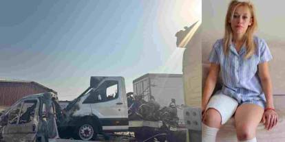 Gaziantep'te İrem’in iki bacağını, şoförsüz tır koparmış!