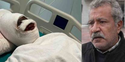 Gaziantep’te Kezzap Dehşeti: Ağır Yaralı Kadın Konuştu, Baba İsyan Etti