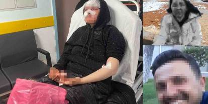 Gaziantep'te boşanmak isteyen karısını öldüresiye darp eden koca tutuklandı