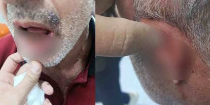 Şehitkamil Devlet Hastanesi’nde Skandal: "Maaşını Ben Veriyorum" Deyip Darp Ettiler