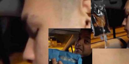 Gaziantep Bu Videoyu Konuşuyor... Parmağını Kaybetti