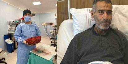 Gaziantep'te Tıp Dünyasını Şaşırtan Olay: Karnından 8 Kiloluk Dev Çıktı!