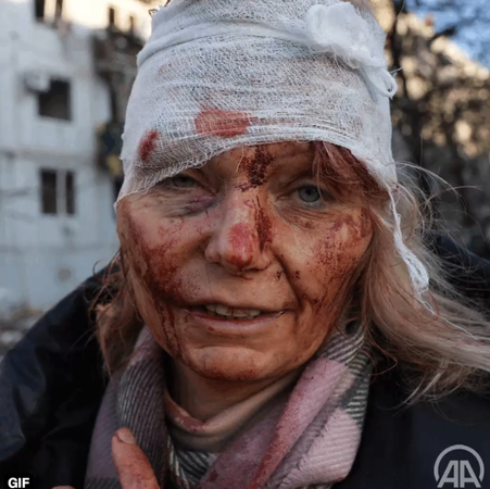 Son dakika: Rusya Ukrayna'ya Hava saldırıları Düzenledi! Savaşın Gerçek Yüzü Gün Ağarınca Ortaya Çıktı! Birçok Sivil Hayatını Kaybetti